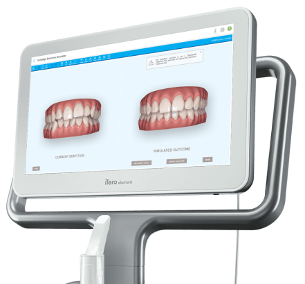 Cerec One-visit dentistry photo